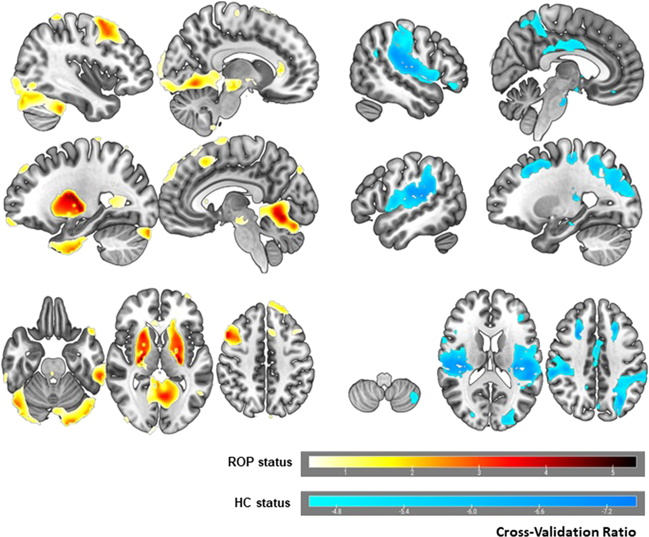 Wenzel_et_al_2021_cog_subtypes.png